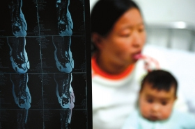 ������Ӥ��5���ס�Сβ�͡�������10���֮һ��ͼ��