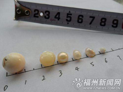 女子将1颗珍珠放糯米中9年“生”出5颗小珍珠(图)