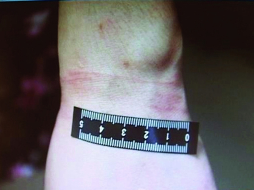 女子和男网友玩“SM游戏”被捆绑14小时勒索5000元