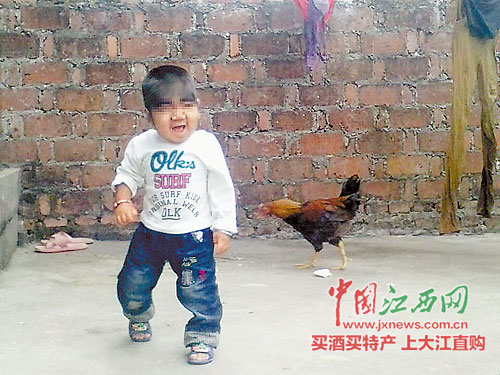 ����1����ͯ��ͷȫ��ë���ܲ������ҹ�������ҽ��ͼ��