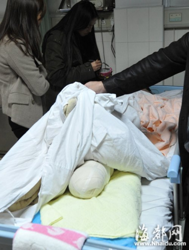 学生候车被碾断腿截肢 家属称公交车两次碾压