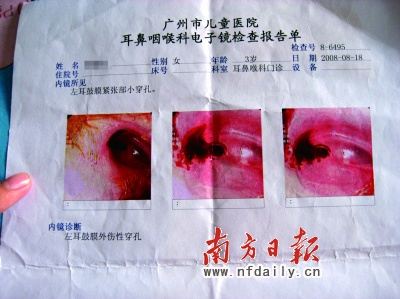 女童耳膜疑被同学戳穿 家长索赔未果状告幼儿园