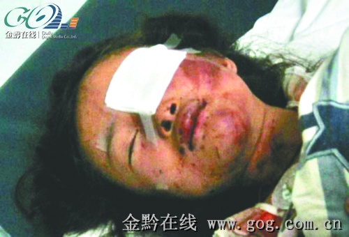 7岁女孩被"挖眼" 行凶女子疑似精神病人(图)