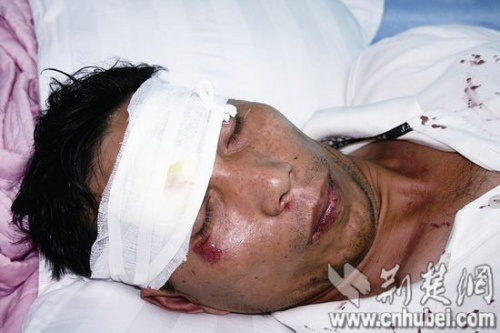 Э��Ա����Ѣ����Ϯͷ����5�������߲���17��