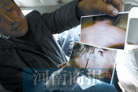 男子酒驾被交警带走询问后死亡 眉脸有血迹(图)