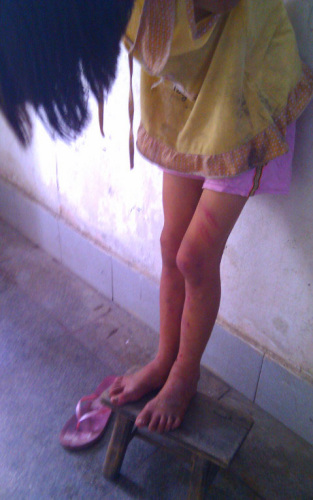 福建石狮华林寺住持虐童调查:女童曾被打断腿