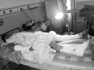 16岁打工少女遭两男子纠缠 同事帮忙被砍断手脚