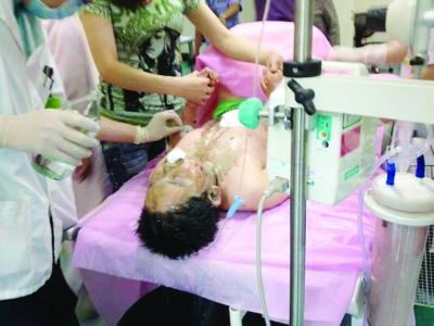 11岁男孩疑被母亲前男友泼强酸街头网店均可买强酸