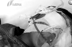 ɽ��6����ͯ����˫�۷���������ΪŮ�ԣ�ͼ��