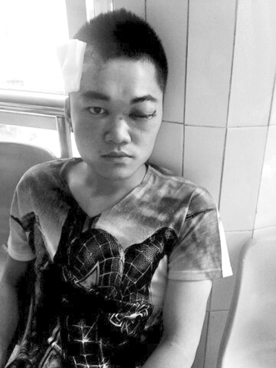 男子返乡次日遭5陌生男子持车锁砸伤左眼