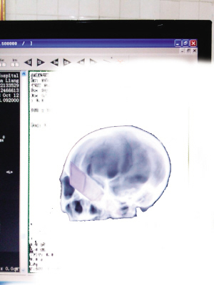 ���ӱ��⵶�����۴̽�­�ڡ����֡�ϵ��������