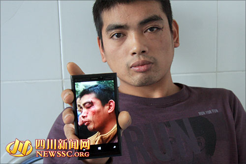 民工医院就诊遭医生无端围殴院方拒绝采访(图)