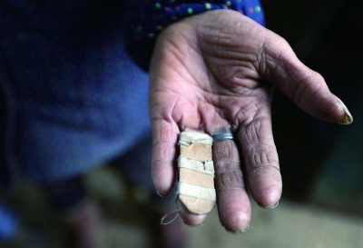 村妇挥刀割下侄儿双耳调查:事发前曾与婆家吵架(3)