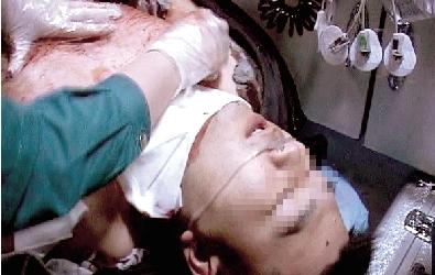男子熟睡中遭前妻砍伤颈部赤裸下身逃出家门(图)