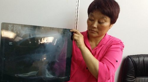 44��Ů�����ڲ�5ö������������ɷ�ƺ�ұ�