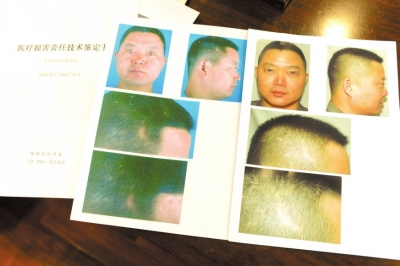 ������������ͷ��������״������Ժ����3��