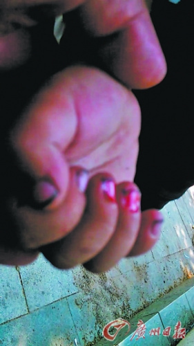 ����Ѱ���޹���3����ӳ����ٵ���4����ָ�ף�ͼ��