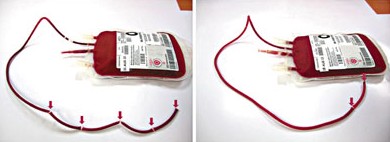 ��۷�������Ѫ�������¼�2��Ůͯ��Ѫ��Ⱦ��ͼ��