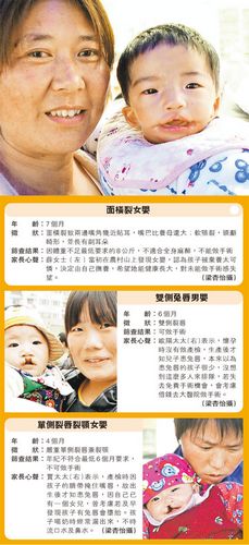 兔唇宝宝遭遗弃被取笑香港医生赴内地参与救助