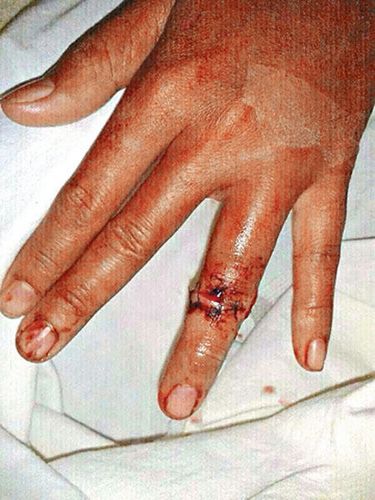 ��ɨ���ƹ���ŭ�������ӡӶ��������ָ��ͼ��