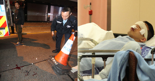 香港警员截查可疑车辆时被拖行受伤 警方追缉逃犯