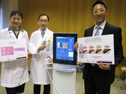 香港中大研究发现逾七成糖尿病人患脂肪肝(图)