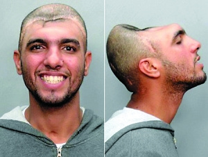 男子酒后撞车只剩半个脑袋 现身说法谈酒驾(图)