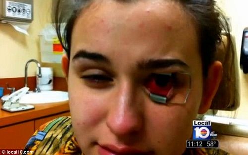 �����۾��ر��γ���Ů�۽�Ĥ����ʳ��ʧ����ͼ��