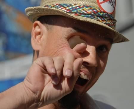 盘点10种不寻常眼球眼窝也能射牛奶图3