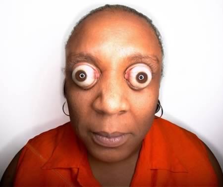 盘点10种"不寻常眼球":眼窝也能射牛奶(图)(4)