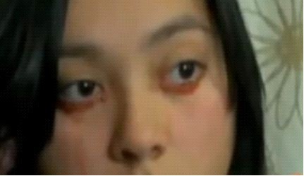 智利一名女子患怪病流泪时眼睛流出鲜血(图)