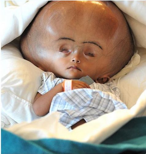 ӡ�ȡ���ͷ���ޡ������ת��Ժ�ѿɻ��ͼ��