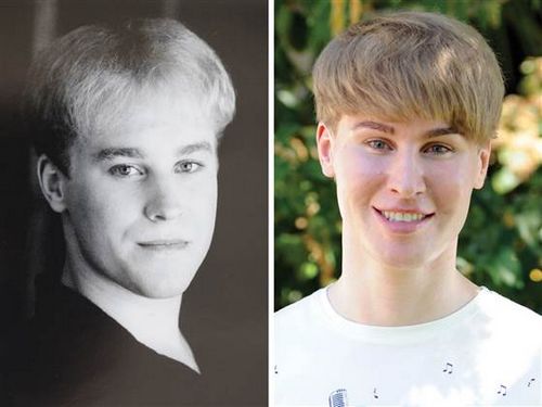 男子花近10万美元整容为“长”得似偶像(图)