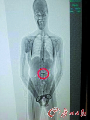 ������������Կ��ıԽ��X������ı�Ʋ���ͼ��