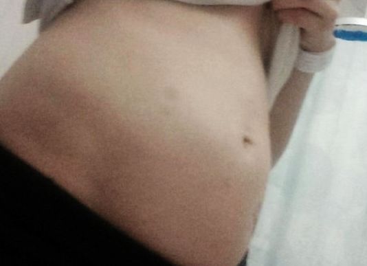 Ӣ��19��Ů�����ֲ���ʳ��θ���������и���ͼ��