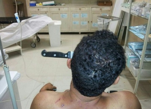 ����ͷ��������10���׳�ذ���������罻̸��ͼ��