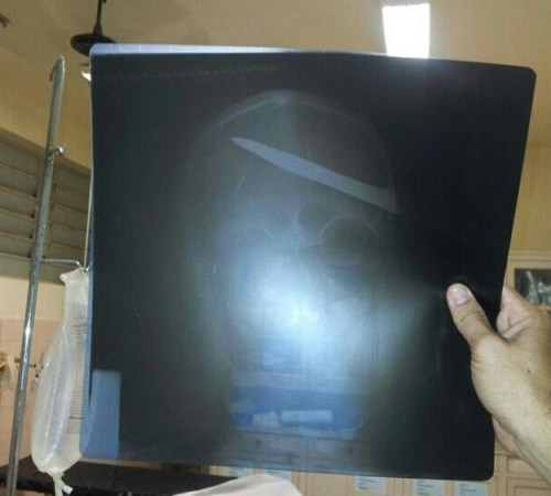 ����ͷ��������10���׳�ذ���������罻̸��ͼ����2��