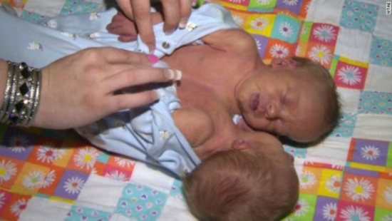 ����Ӥ���������������մ�ĸ�������ָͼ��