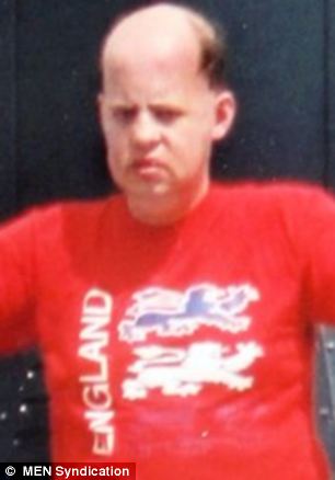 英国一名男子误将假牙吞下肚三年后内出血丧命