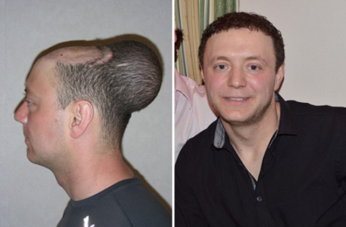 Ӣ������ͷƤֲ�롰����״�轺�ҡ���������ͼ��