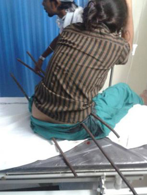 ӡ����Ůˤ���ݶ���3���ֽ�̴��漣�Ҵ棨ͼ��