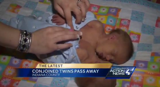 Ů�Ӳ�������Ӥ�ܾ�������ѡһ��Ӥ����ز��