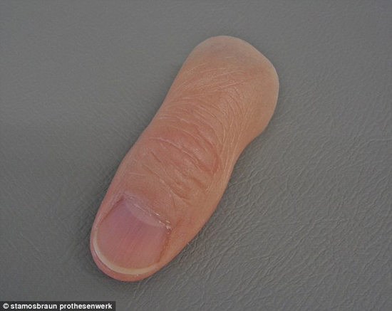 "超仿真"假肢难辨真假 外观好看活动差(图)