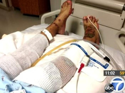 ����Ů���ú����ֲ�ȫ��Ƥ�����ڶ������գ�ͼ��