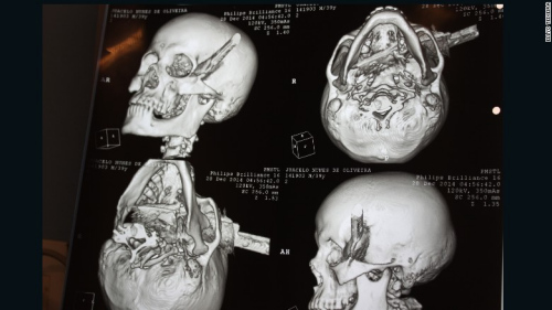 �����������������̴�ͷ����ҽ���漣��ͼ��