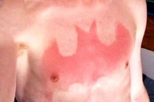 �������С�ɹ��������ҽ��������ɹ��Ƥ������ͼ��