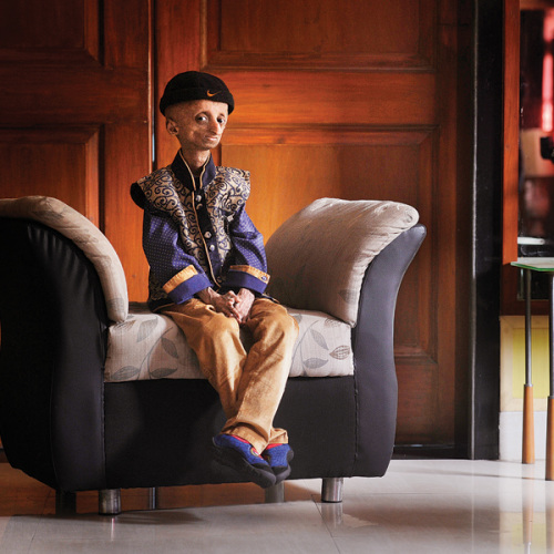 δ����˥��ӡ��14���к�����˥֢���ؽ�Ϊ25��