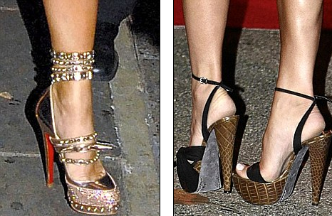 贝嫂超高跟鞋穿出祸 脚趾严重变形需开刀(组图)