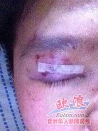 马德里华商父女遭顾客殴打反被对方诬告(图)