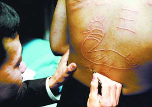 皮肤上能划出画面 男子自称有"特异功能"(图)